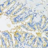 P450SCC / CYP11A1 Antibody - Immunohistochemistry of paraffin-embedded Rat lung using CYP11A1 Polyclonal Antibody at dilution of 1:100 (40x lens).