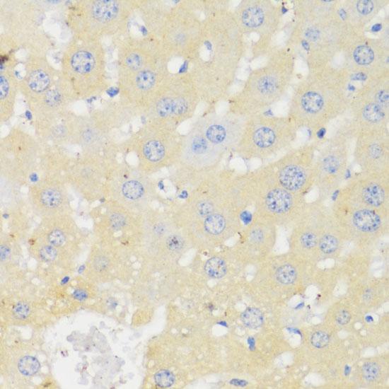 P450SCC / CYP11A1 Antibody - Immunohistochemistry of paraffin-embedded Mouse liver using CYP11A1 Polyclonal Antibody at dilution of 1:100 (40x lens).