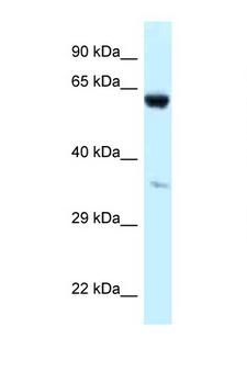 P4HA1 Antibody - P4HA1 antibody Western blot of 293T Cell lysate. Antibody concentration 1 ug/ml.  This image was taken for the unconjugated form of this product. Other forms have not been tested.