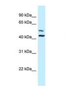 P4HA1 Antibody - P4HA1 antibody Western blot of 3 Cell lysate. Antibody concentration 1 ug/ml.  This image was taken for the unconjugated form of this product. Other forms have not been tested.