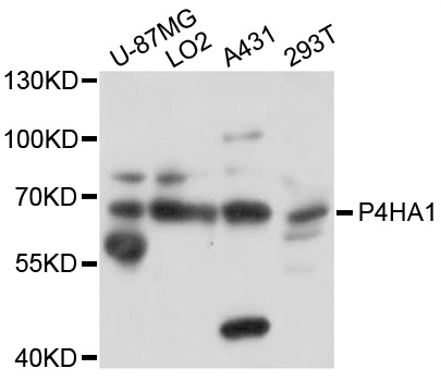 P4HA1 Antibody - Western blot analysis of extracts of various cell lines, using P4HA1 antibody at 1:1000 dilution. The secondary antibody used was an HRP Goat Anti-Rabbit IgG (H+L) at 1:10000 dilution. Lysates were loaded 25ug per lane and 3% nonfat dry milk in TBST was used for blocking. An ECL Kit was used for detection and the exposure time was 8s.