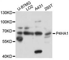 P4HA1 Antibody - Western blot analysis of extracts of various cell lines, using P4HA1 antibody at 1:1000 dilution. The secondary antibody used was an HRP Goat Anti-Rabbit IgG (H+L) at 1:10000 dilution. Lysates were loaded 25ug per lane and 3% nonfat dry milk in TBST was used for blocking. An ECL Kit was used for detection and the exposure time was 8s.