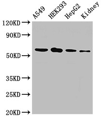 P4HA1 Antibody - Positive WB detected in:A549 whole cell lysate,HEK293 whole cell lysate,HepG2 whole cell lysate,Rat kidney tissue;All lanes:P4HA1 antibody at 2.5?g/ml;Secondary;Goat polyclonal to rabbit IgG at 1/50000 dilution;Predicted band size: 62,61,59 KDa;Observed band size: 62 KDa;