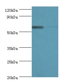 P4HA2 Antibody - Western blot. All lanes: P4HA2 antibody at 6 ug/ml. Lane 1: HepG2 whole cell lysate. Lane 2: 293T whole cell lysate. Secondary antibody: Goat polyclonal to rabbit at 1:10000 dilution. Predicted band size: 61 kDa. Observed band size: 61 kDa Immunohistochemistry.