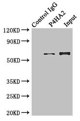 P4HA2 Antibody - Immunoprecipitating P4HA2 in Hela whole cell lysate Lane 1: Rabbit monoclonal IgG (1µg) instead of P4HA2 Antibody in Hela whole cell lysate.For western blotting, a HRP-conjugated anti-rabbit IgG, specific to the non-reduced form of IgG was used as the Secondary antibody (1/50000) Lane 2: P4HA2 Antibody (4µg) + Hela whole cell lysate (500µg) Lane 3: Hela whole cell lysate (20µg)