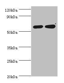 P4HA2 Antibody - Western blot All lanes: P4HA2 antibody at 6µg/ml Lane 1: HepG2 whole cell lysate Lane 2: 293T whole cell lysate Secondary Goat polyclonal to rabbit IgG at 1/10000 dilution Predicted band size: 61 kDa Observed band size: 61 kDa