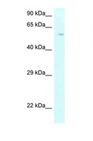 P4HA2 Antibody - P4HA2 antibody Western blot of HepG2 Cell lysate. Antibody concentration 1 ug/ml.  This image was taken for the unconjugated form of this product. Other forms have not been tested.