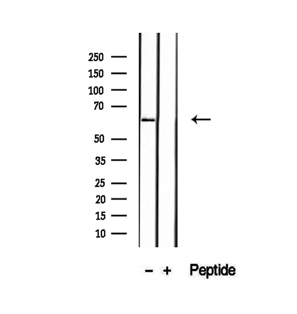 P4HA2 Antibody - Western blot analysis of extracts of MCF-7 cells using P4HA2 antibody.