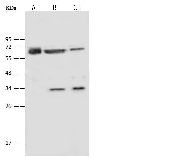 P4HA2 Antibody - Anti-P4HA2 rabbit polyclonal antibody at 1:2000 dilution. Lane A: U251 MG Whole Cell Lysate. Lane B: HeLa Whole Cell Lysate. Lane C: H1299 Whole Cell Lysate. Lysates/proteins at 30 ug per lane. Secondary: Goat Anti-Rabbit IgG (H+L)/HRP at 1/10000 dilution. Developed using the ECL technique. Performed under reducing conditions. Predicted band size: 61 kDa.