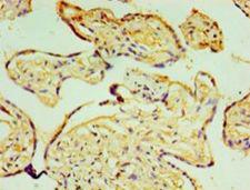 P4HA3 Antibody - Immunohistochemistry of paraffin-embedded human placenta tissue using antibody at 1:100 dilution.  This image was taken for the unconjugated form of this product. Other forms have not been tested.