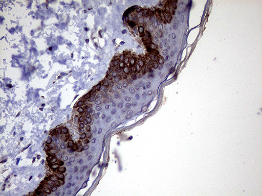 P4HA3 Antibody - Immunohistochemical staining of paraffin-embedded Human skin tissue within the normal limits using anti-P4HA3 mouse monoclonal antibody. (Heat-induced epitope retrieval by 1mM EDTA in 10mM Tris buffer. (pH8.5) at 120 oC for 3 min. (1:1000)