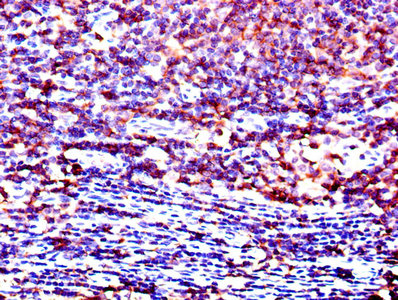 p56lck / LCK Antibody - Immunohistochemistry of paraffin-embedded human lymph node tissue using LCK Antibody at dilution of 1:100