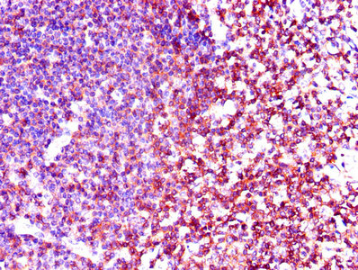 p56lck / LCK Antibody - Immunohistochemistry of paraffin-embedded human tonsil tissue using LCK Antibody at dilution of 1:100