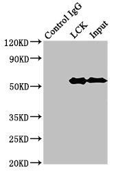 p56lck / LCK Antibody - Immunoprecipitating LCK in Jurkat whole cell lysate Lane 1: Rabbit control IgG (1µg) instead of LCK Antibody in Jurkat whole cell lysate.For western blotting, a HRP-conjugated Protein G antibody was used as the secondary antibody (1/2000) Lane 2: LCK Antibody (8µg) + Jurkat whole cell lysate (500µg) Lane 3: Jurkat whole cell lysate (10µg)