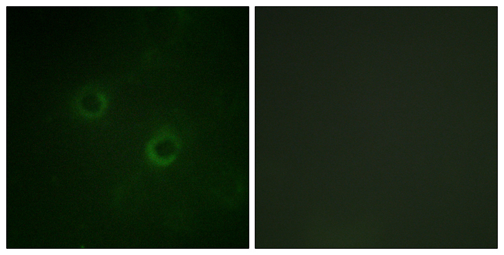 p56lck / LCK Antibody - Immunofluorescence analysis of COS7 cells, using Lck Antibody. The picture on the right is blocked with the synthesized peptide.