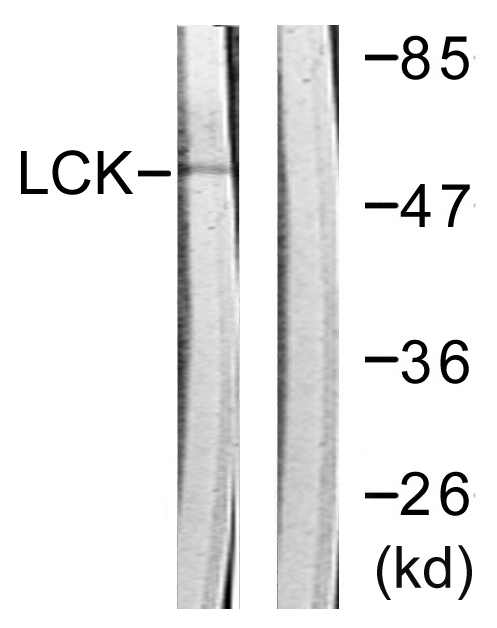 p56lck / LCK Antibody - Western blot analysis of lysates from Jurkat cells, using Lck Antibody. The lane on the right is blocked with the synthesized peptide.