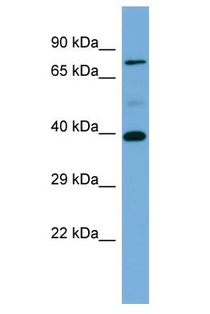 p56lck / LCK Antibody - p56lck / LCK antibody Western Blot of Fetal Muscle. Antibody dilution: 1 ug/ml.  This image was taken for the unconjugated form of this product. Other forms have not been tested.