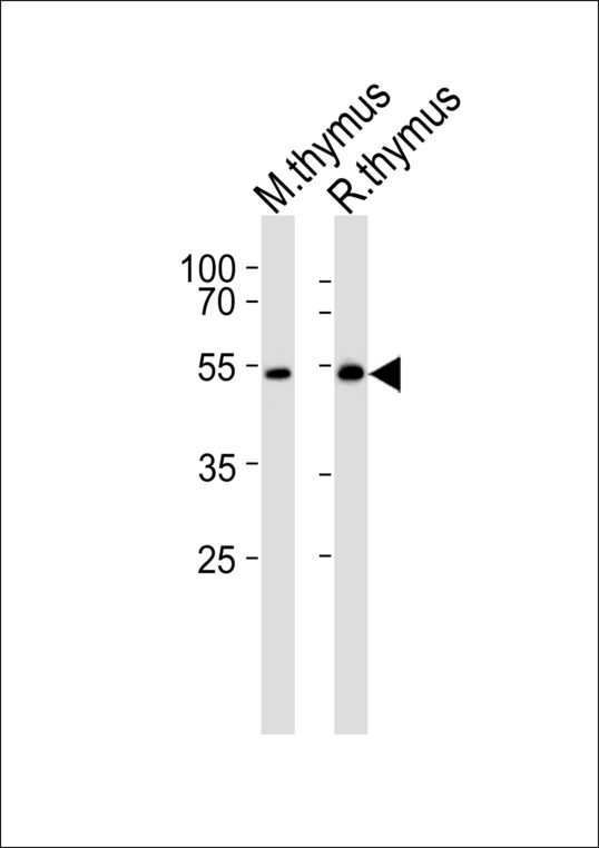 p56lck / LCK Antibody - Western blot of lysates from mouse thymus and rat thymus tissue lysate(from left to right), using LSK Antibody (I37). Antibody was diluted at 1:1000 at each lane. A goat anti-rabbit IgG H&L (HRP) at 1:5000 dilution was used as the secondary antibody. Lysates at 35ug per lane.