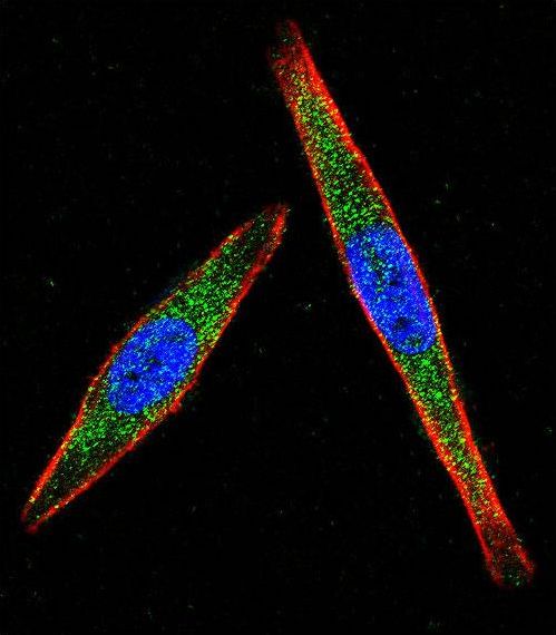 p56lck / LCK Antibody - Confocal immunofluorescence of LCK Antibody with A2058 cell followed by Alexa Fluor 488-conjugated goat anti-rabbit lgG (green). Actin filaments have been labeled with Alexa Fluor 555 phalloidin (red). DAPI was used to stain the cell nuclear (blue).