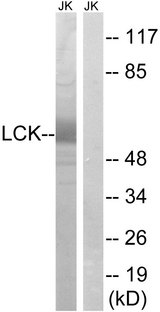 p56lck / LCK Antibody - Western blot analysis of lysates from Jurkat cells, using Lck Antibody. The lane on the right is blocked with the synthesized peptide.