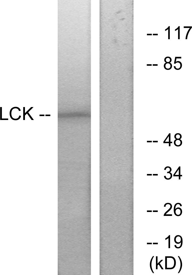 p56lck / LCK Antibody - Western blot analysis of lysates from 293 cells, treated with serum 15% 10', using Lck Antibody. The lane on the right is blocked with the synthesized peptide.