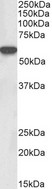 p56lck / LCK Antibody - Goat Anti-LCK (aa39-52) Antibody (0.3µg/ml) staining of Rat Thymus lysate (35µg protein in RIPA buffer). Primary incubation was 1 hour. Detected by chemiluminescencence.