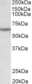 p56lck / LCK Antibody - LCK antibody (0.1 ug/ml) staining of Human Thymus lysate (35 ug protein in RIPA buffer). Primary incubation was 1 hour. Detected by chemiluminescence.