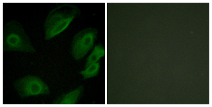 p56lck / LCK Antibody - Immunofluorescence analysis of HeLa cells, using Lck Antibody. The picture on the right is blocked with the synthesized peptide.