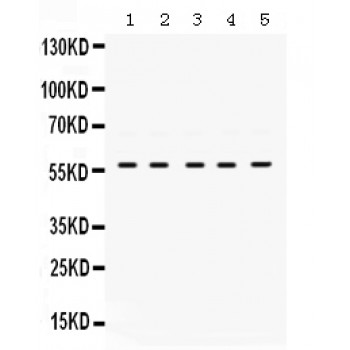 p56lck / LCK Antibody - Lck antibody Western blot. All lanes: Anti Lck at 0.5 ug/ml. Lane 1: HUT Whole Cell Lysate at 40 ug. Lane 2: JURKAT Whole Cell Lysate at 40 ug. Lane 3: RAJI Whole Cell Lysate at 40 ug. Lane 4: CEM Whole Cell Lysate at 40 ug. Lane 5: K562 Whole Cell Lysate at 40 ug. Predicted band size: 58 kD. Observed band size: 58 kD.