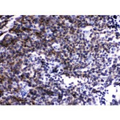 p56lck / LCK Antibody - Lck antibody IHC-paraffin. IHC(P): Mouse Lymphadenoma Tissue.