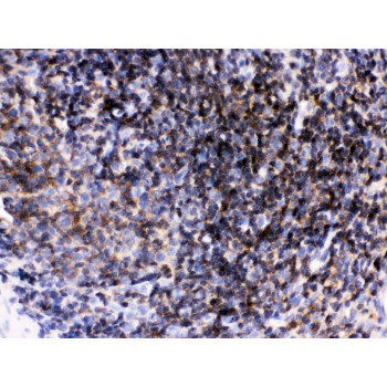 p56lck / LCK Antibody - Lck antibody IHC-paraffin. IHC(P): Rat Lymphadenoma Tissue.
