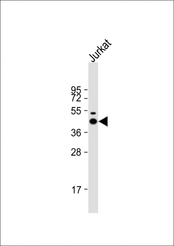p56lck / LCK Antibody - Anti-LCK Antibody at 1:2000 dilution + Jurkat whole cell lysate Lysates/proteins at 20 ug per lane. Secondary Goat Anti-mouse IgG, (H+L), Peroxidase conjugated at 1:10000 dilution. Predicted band size: 58 kDa. Blocking/Dilution buffer: 5% NFDM/TBST.