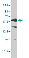p56lck / LCK Antibody - LCK monoclonal antibody (M01), clone 3F7-F5 Western Blot analysis of LCK expression in Jurkat.