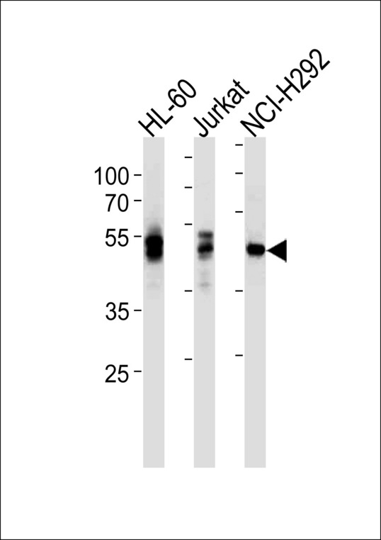 p56lck / LCK Antibody - LCK Antibody western blot of HL-60,Jurkat,NCI-H292 cell line lysates (35 ug/lane). The LCK antibody detected the LCK protein (arrow).