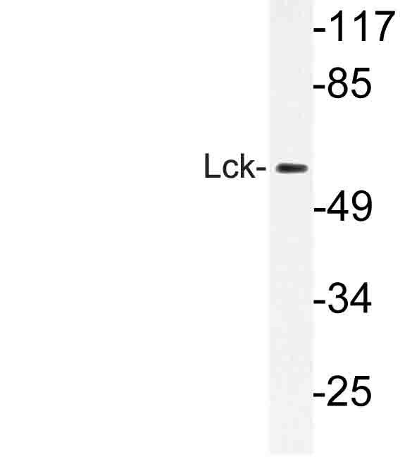 p56lck / LCK Antibody - Western blot of Lck (G534) pAb in extracts from Jurkat cells.