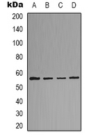 p56lck / LCK Antibody - Western blot analysis of LCK expression in HeLa (A); Jurkat (B); mouse kidney (C); rat liver (D) whole cell lysates.