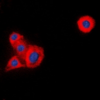 p56lck / LCK Antibody - Immunofluorescent analysis of LCK staining in HeLa cells. Formalin-fixed cells were permeabilized with 0.1% Triton X-100 in TBS for 5-10 minutes and blocked with 3% BSA-PBS for 30 minutes at room temperature. Cells were probed with the primary antibody in 3% BSA-PBS and incubated overnight at 4 deg C in a humidified chamber. Cells were washed with PBST and incubated with a DyLight 594-conjugated secondary antibody (red) in PBS at room temperature in the dark. DAPI was used to stain the cell nuclei (blue).