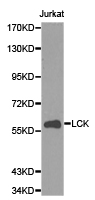 p56lck / LCK Antibody - Western blot of extracts of Jurkat cell lines, using LCK antibody.