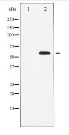 p56lck / LCK Antibody - Western blot of Lck expression in HeLa whole cell lysates,The lane on the left is treated with the antigen-specific peptide.