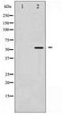 p56lck / LCK Antibody - Western blot of Lck expression in Jurkat whole cell lysates,The lane on the left is treated with the antigen-specific peptide.