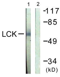 p56lck / LCK Antibody - Peptide - + Immunofluorescence analysis of HeLa cells, using Lck (Ab-505) antibody.