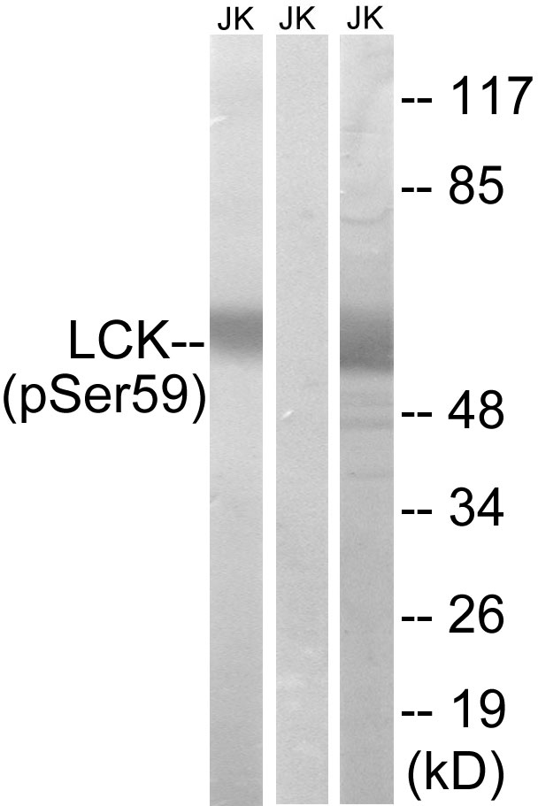 p56lck / LCK Antibody - Western blot analysis of lysates from Jurkat cells treated with IFN 2500U/ML 30', using LCK (Phospho-Ser59) Antibody. The lane on the right is blocked with the phospho peptide.