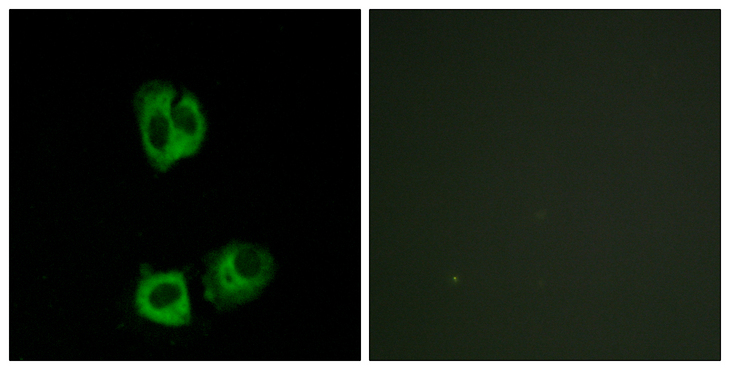 p56lck / LCK Antibody - Immunofluorescence analysis of HeLa cells, using Lck (Phospho-Tyr393) Antibody. The picture on the right is blocked with the phospho peptide.