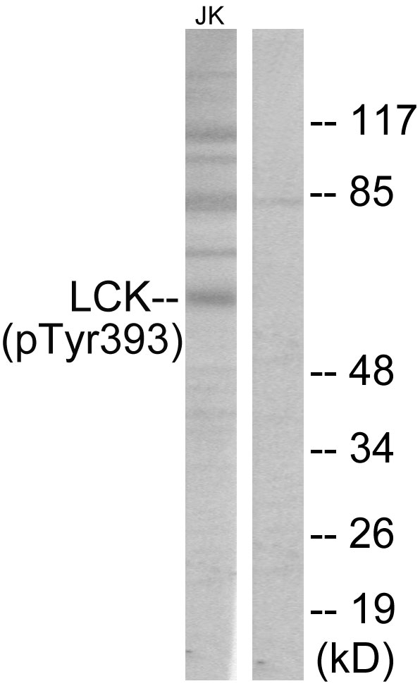 p56lck / LCK Antibody - Western blot analysis of lysates from Jurkat cells, using Lck (Phospho-Tyr393) Antibody. The lane on the right is blocked with the phospho peptide.