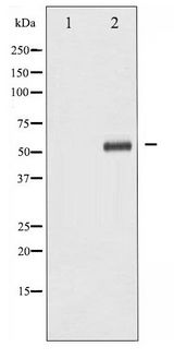 p56lck / LCK Antibody - Western blot of Lck phosphorylation expression in HeLa whole cell lysates,The lane on the left is treated with the antigen-specific peptide.