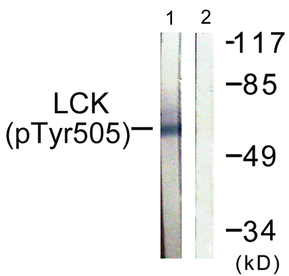 p56lck / LCK Antibody - Western blot analysis of lysates from Jurkat cells, using Lck (Phospho-Tyr505) Antibody. The lane on the right is blocked with the phospho peptide.