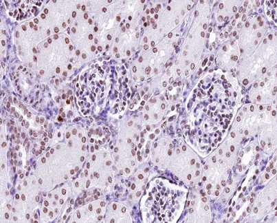 p56lck / LCK Antibody - 1:200 staining human kidney tissue by IHC-P. The tissue was formaldehyde fixed and a heat mediated antigen retrieval step in citrate buffer was performed. The tissue was then blocked and incubated with the antibody for 1.5 hours at 22°C. An HRP conjugated goat anti-rabbit antibody was used as the secondary.