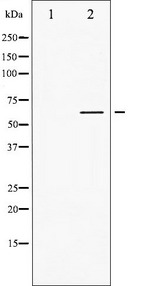 p56lck / LCK Antibody - Western blot analysis of Lck phosphorylation expression in Jurkat whole cells lysates. The lane on the left is treated with the antigen-specific peptide.