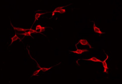 p56lck / LCK Antibody - Staining HeLa cells by IF/ICC. The samples were fixed with PFA and permeabilized in 0.1% Triton X-100, then blocked in 10% serum for 45 min at 25°C. The primary antibody was diluted at 1:200 and incubated with the sample for 1 hour at 37°C. An Alexa Fluor 594 conjugated goat anti-rabbit IgG (H+L) Ab, diluted at 1/600, was used as the secondary antibody.