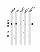 p58 / PSMD3 Antibody - All lanes: Anti-PSMD3 Antibody (C-Term) at 1:2000 dilution Lane 1: Jurkat whole cell lysate Lane 2: Hela whole cell lysate Lane 3: HepG2 whole cell lysate Lane 4: MCF-7 whole cell lysate Lane 5: NIH/3T3 whole cell lysate Lysates/proteins at 20 µg per lane. Secondary Goat Anti-Rabbit IgG, (H+L), Peroxidase conjugated at 1/10000 dilution. Predicted band size: 61 kDa Blocking/Dilution buffer: 5% NFDM/TBST.